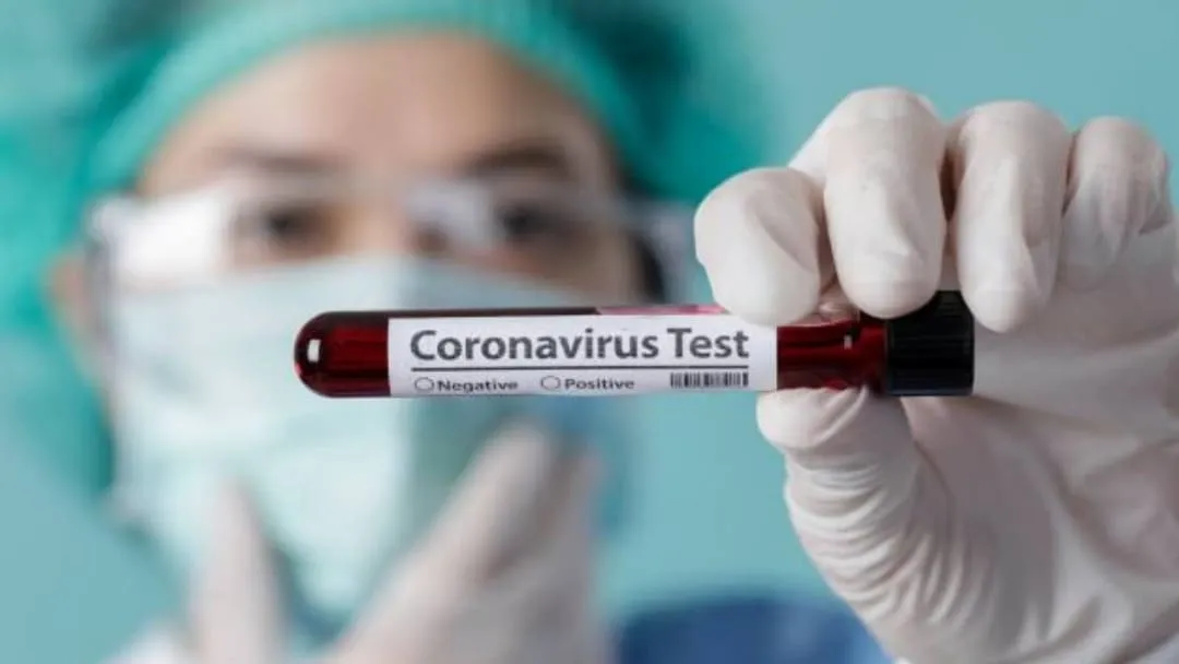 Salah satu dampak terbesar zoonosis adalah pandemi covid-19.