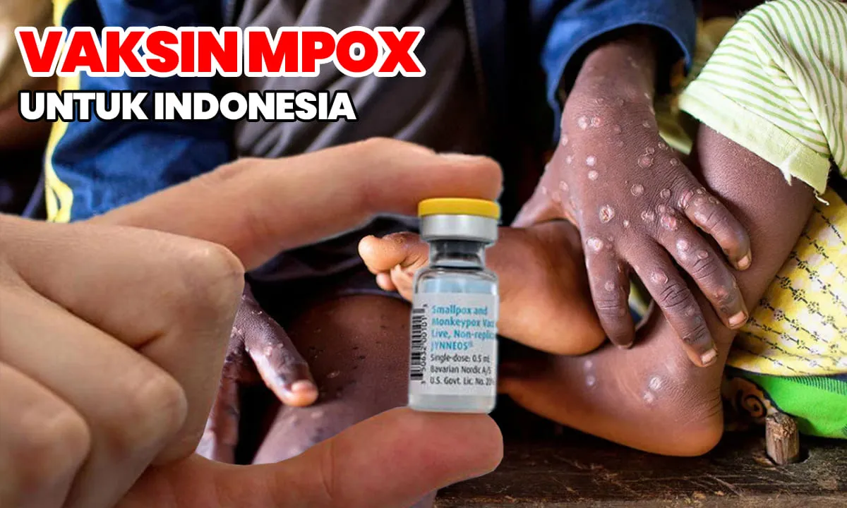 Kemenkes RI sedang menyiapkan ribuan dosis vaksinas Mpox untuk Indonesia untuk mengatasi kasus cacar monyet.